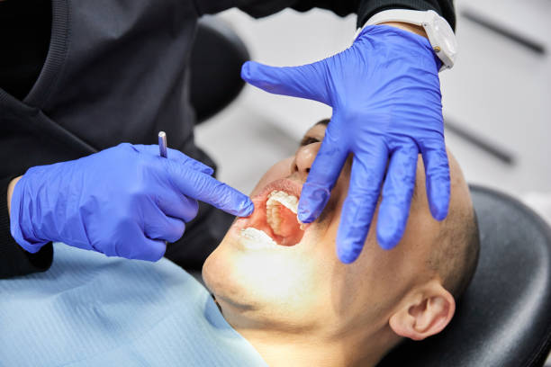 Best Emergency Root Canal Treatment in Sparta, GA