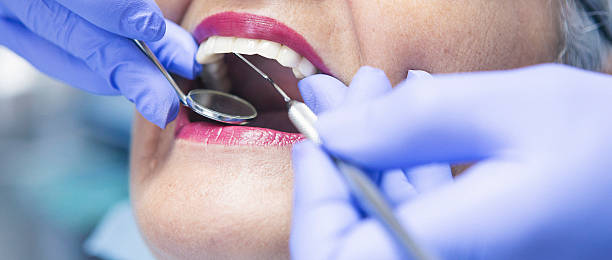 Best Emergency Dental Care for Broken or Chipped Teeth in Sparta, GA